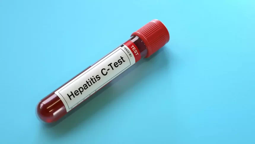Tratamento natural para hepatite C